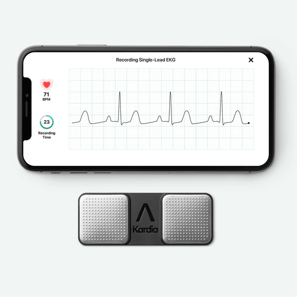 KardiaMobile and iPhone with EKG tracing