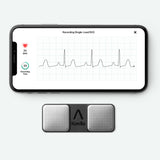 KardiaMobile and iPhone with EKG tracing