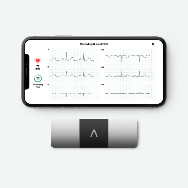 KardiaMobile 6L with iPhone showing EKG tracing